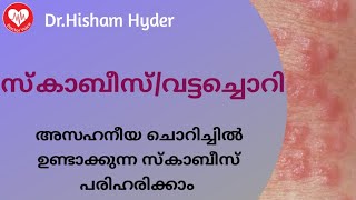 Scabies Malayalam  അസഹനീയ ചൊറിച്ചിൽ ഉണ്ടാക്കുന്ന സ്കാബീസ് എങ്ങനെ പരിഹരിക്കാംവട്ടച്ചൊറി  Ring Worm [upl. by Eyram]