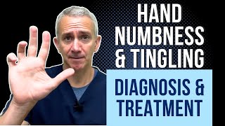 Hand Numbness amp Tingling Diagnosis amp Treatment [upl. by Akahc139]