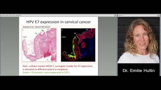 Lecture 2 Part 2 Molecular Mechanisms of HPV induced cancer [upl. by Slaby357]