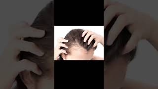 Do you have Hyperandrogenism with PCOS acne excessive hair irregular periods hair loss [upl. by Cornelius]