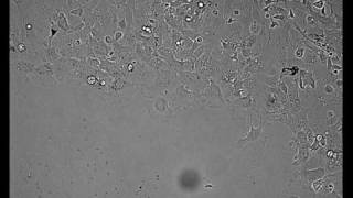 Fish Scale Keratocytes  Tissue and Cell Motility [upl. by Emerson]