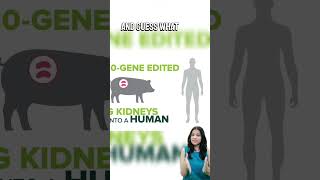 Medical Breakthrough First Ever Pig Kidney Transplant to Human youtubeshorts [upl. by Wivina]