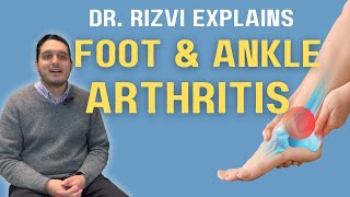 Treatment For Arthritis In Foot And Ankle  Dr Rizvi Explains [upl. by Airdnaz156]