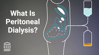 Peritoneal Dialysis At Home Treatment for Kidney Failure  Mass General Brigham [upl. by Boesch]