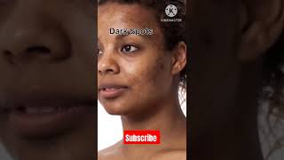 Cream for Dark spots pigmentation blemishes uneven skintone tanning [upl. by Ttocserp]