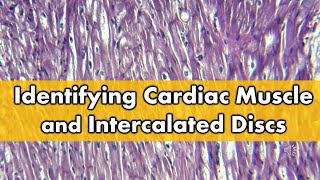 Fibrocartilage vs Cardiac Muscle Histology FAQ [upl. by Ormiston]