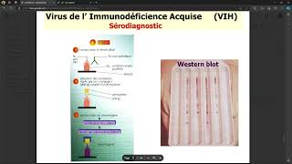 Virologie  VIH FMPC [upl. by Rogerio]