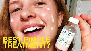 Best Pimple Spot Treatment I Try Mario Badescu Drying Lotion [upl. by Huppert]