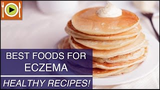 Best Foods for Eczema  Healthy Recipes [upl. by Keynes]