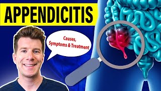 Doctor explains APPENDICITIS  Causes symptoms and treatment [upl. by Ecikram769]