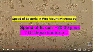 Speed of Bacteria in Wet Mount Microscopy Citrobacter farmeri Mag1600X [upl. by Aphrodite]