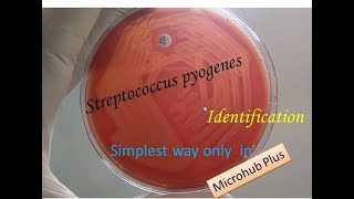 Streptococcus pyogenes identification [upl. by Retsev]