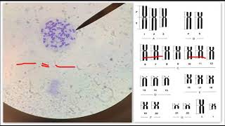 Lec 4 chromosomes karyotype  banding  groups and nomenclatures [upl. by Dove70]