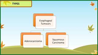 Esophageal Carcinoma  Adenocarcinoma [upl. by Lokcin679]