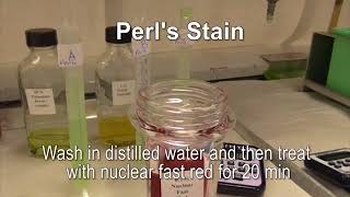 Perls stain with sound [upl. by Ahsaetal]