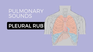 05  Lung Sounds  Pleural friction rub 🎧 [upl. by Loughlin691]