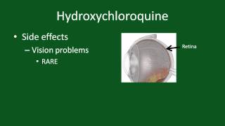 Hydroxychloroquine for Rheumatoid Arthritis [upl. by Bergmans]