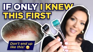 The Dermaroller Watch This BEFORE Microneedling What I wish I knew Before I Started Dermarolling [upl. by Derfiniw]