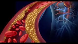 Foods To Lower Your Bad Cholesterol LDL [upl. by Adikram]