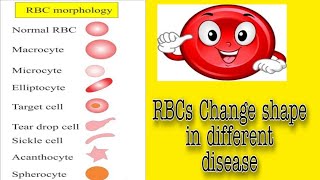 RBC Morphology Lecture No 1 [upl. by Aleekat778]