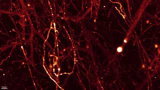 Glutamatergic neurons in the mouse brain sparse labeling [upl. by Gnot]