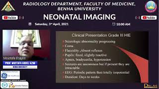 Hypoxic Ischemic Encephalopathy pathogenesis and management update [upl. by Initirb]