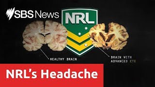 Brain disease found in former NRL players linked to repetitive head injuries [upl. by Rashidi]