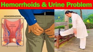 Relieve Hemorrhoids and Improve Urinary Health  Taichi Zidong [upl. by Lenee325]