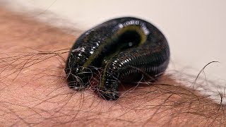 How Leeches are used in Modern Surgery  Earth Science [upl. by Ayisan173]