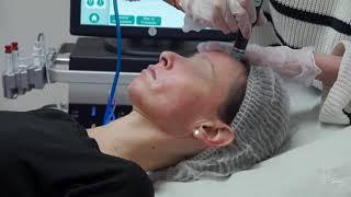 Hydrafacial  la séance complète de nettoyage de peau [upl. by Jacobba]