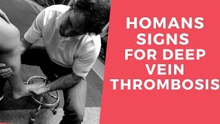 Homans Sign for Deep Vein Thrombosis [upl. by Marcel658]