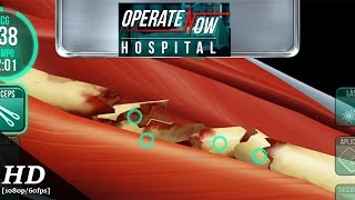 Operate Now Hospital Android Gameplay 1080p60fps [upl. by Adnarim]