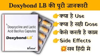 doxybond lb capsule uses  price  composition  dose  side effects  review  in hindi [upl. by Ecnirp]