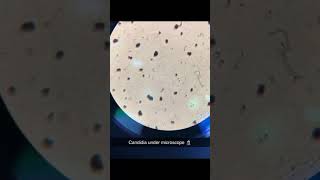 Gram stainBacteria Gcocci and fungi candida under microscope [upl. by Georg428]