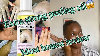 Extra strong peeling oilchemicalpeelinghonestreview [upl. by Ahsienom]