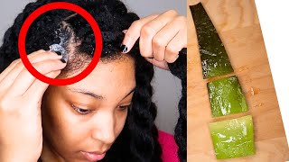 9 WAYS TO USE ALOE VERA GEL FOR HAIR GROWTH  GET THICKER HAIR [upl. by Oniotna]