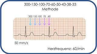 EKGBefundung Herzfrequenz in Sekunden bestimmen 300150100Methode [upl. by Ralston202]