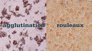 How to Perform a Saline Agglutination Test [upl. by Imrots]