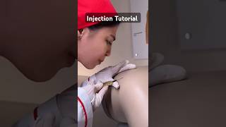 Injection Tutorial tutorial injection shorts littos [upl. by Joung168]