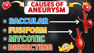 Understanding  Causes Of Aneurysm 😍 [upl. by Ettenahs383]