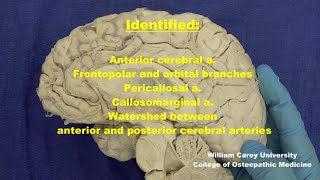 Anterior cerebral artery Medial surface of hemisphere neuroanatomy arteries medicalstudent [upl. by Noyes]