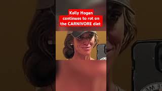 Kelly Hogan proves the CARNIVORE diet will rot your body carnivorediet carnivoreketo funny [upl. by Irby]