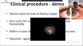 Refraction Objective Retinoscopy amp Subjective Acceptance  Sankara Academy of Vision [upl. by Carmelle425]