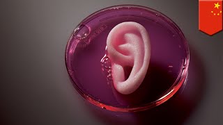 Microtia Scientists in China grow new ears for five kids with ear defects  TomoNews [upl. by Ivers]