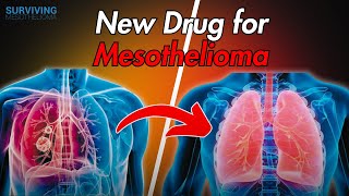 Could Lenvatinib Help Mesothelioma Patients Live Longer [upl. by Arimihc805]