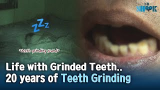 Teeth Grinding ASMR Attention All the Teeth Grinders The Risk or Bruxism [upl. by Bathsheb]