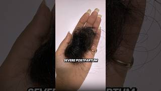 The Hair Growth Serum That Grew My Hair back hairgrowth hairfall hairfallsolution wishcare [upl. by Papageno785]