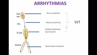 Treatment of Arrhythmia Pharmacology  Antiarrhythmic Drugs Pharmacology Mnemonics  Part 1 [upl. by Arela]