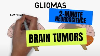 2Minute Neuroscience Brain tumors [upl. by Anirahs]