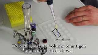 How to perform a Rapid Slide Agglutination Test [upl. by Zebaj]